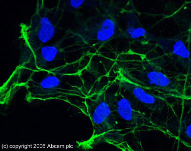 Immunocytochemistry/ Immunofluorescence - Anti-Doublecortin antibody (AB18723)