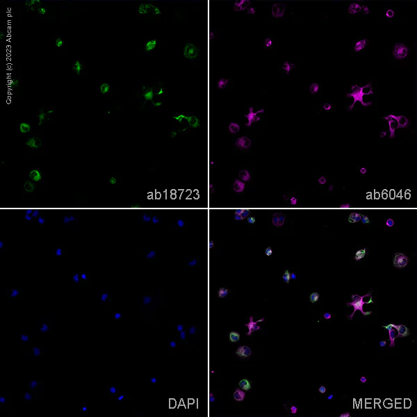 Immunocytochemistry/ Immunofluorescence - Anti-Doublecortin antibody (AB18723)