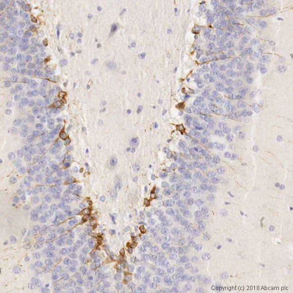 Immunohistochemistry (Formalin/PFA-fixed paraffin-embedded sections) - Anti-Doublecortin antibody (AB18723)