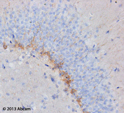 Immunohistochemistry (Formalin/PFA-fixed paraffin-embedded sections) - Anti-Doublecortin antibody (AB18723)