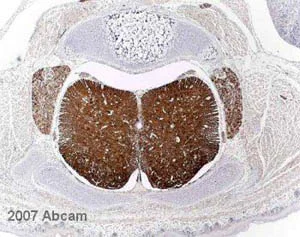 Immunohistochemistry (Formalin/PFA-fixed paraffin-embedded sections) - Anti-Doublecortin antibody (AB18723)