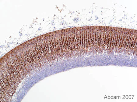 Immunohistochemistry (Formalin/PFA-fixed paraffin-embedded sections) - Anti-Doublecortin antibody (AB18723)