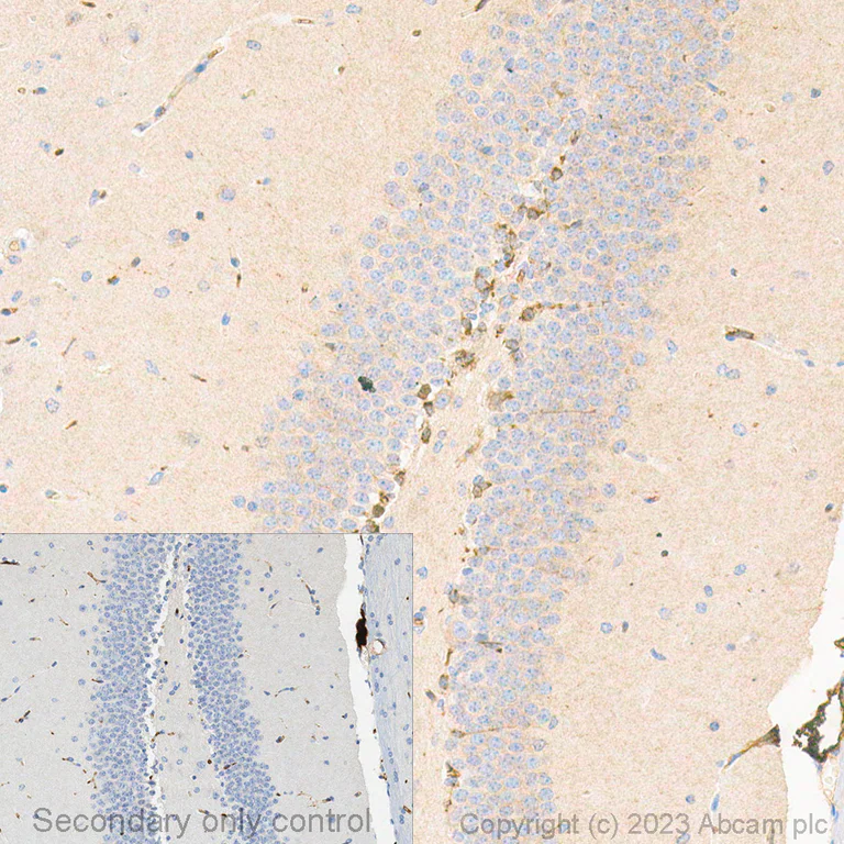Immunohistochemistry (Formalin/PFA-fixed paraffin-embedded sections) - Anti-Doublecortin antibody (AB18723)