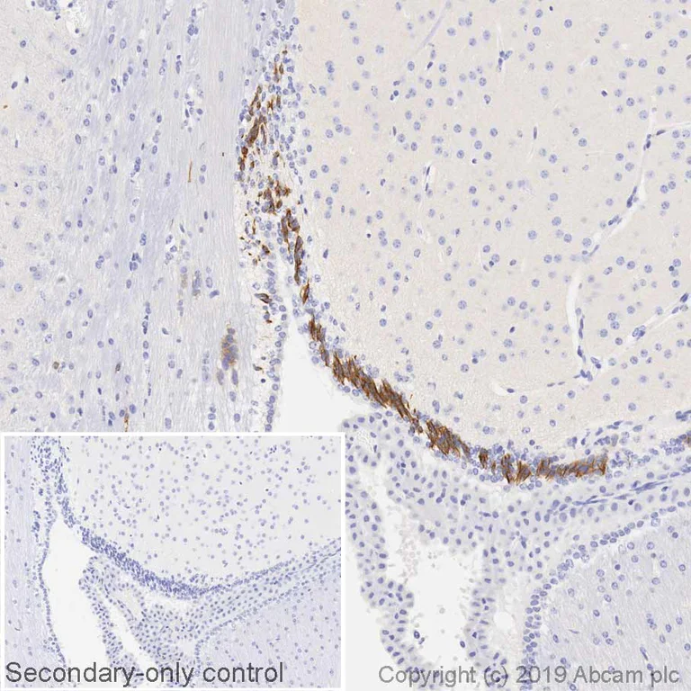 Immunohistochemistry (Formalin/PFA-fixed paraffin-embedded sections) - Anti-Doublecortin antibody (AB18723)