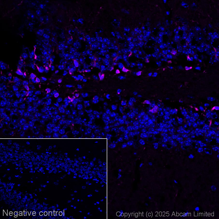 Immunohistochemistry (Frozen sections) - Anti-Doublecortin antibody (ab18723), expandable thumbnail