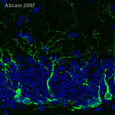 Immunohistochemistry (PFA perfusion fixed frozen sections) - Anti-Doublecortin antibody (AB18723)