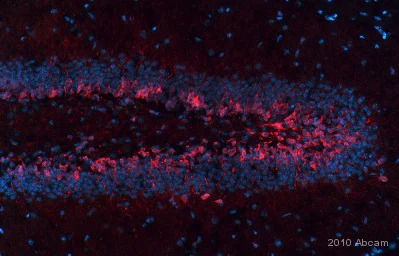 Immunohistochemistry (PFA perfusion fixed frozen sections) - Anti-Doublecortin antibody (AB18723)