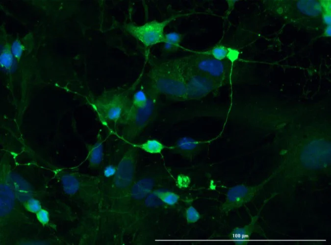 Immunocytochemistry/ Immunofluorescence - Anti-Doublecortin antibody (AB235153)