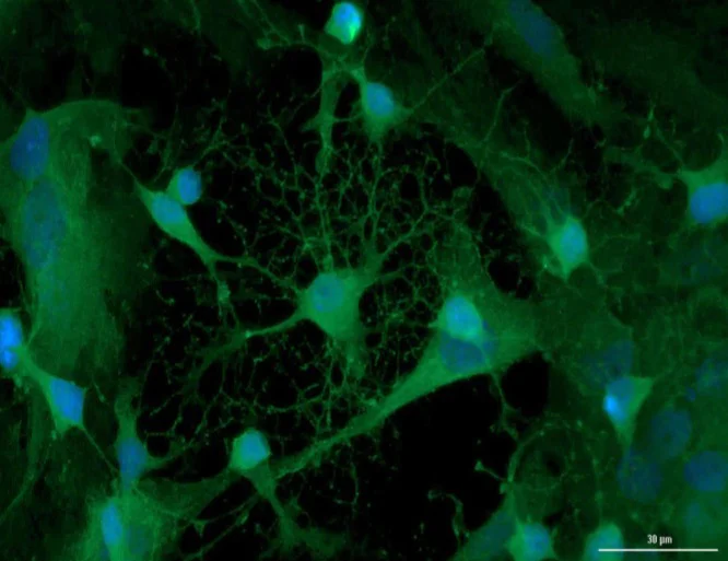 Immunocytochemistry/ Immunofluorescence - Anti-Doublecortin antibody (AB235153)