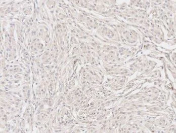 Immunohistochemistry (Formalin/PFA-fixed paraffin-embedded sections) - Anti-Doublecortin antibody (AB235153)