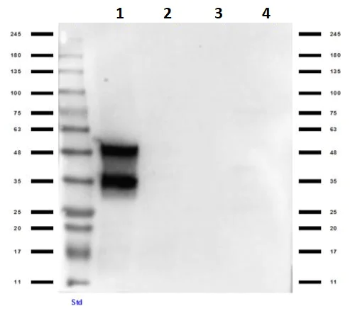Western blot - Anti-Doublecortin antibody (AB235153)