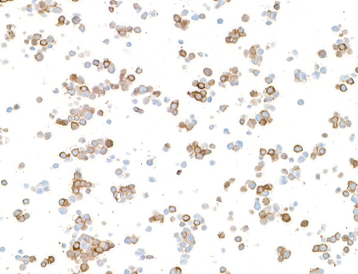 Immunocytochemistry - Anti-Doublecortin antibody [BLR168J] - BSA free (AB314076), expandable thumbnail