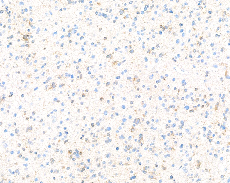 Immunohistochemistry (Formalin/PFA-fixed paraffin-embedded sections) - Anti-Doublecortin antibody [BLR168J] - BSA free (AB314076)