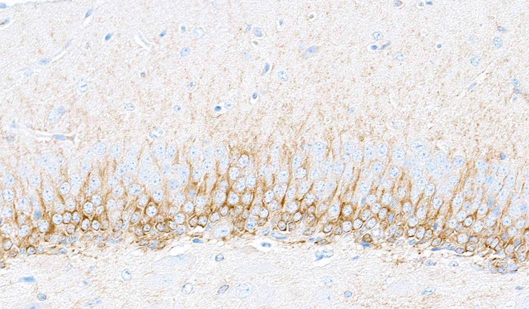 Immunohistochemistry (Formalin/PFA-fixed paraffin-embedded sections) - Anti-Doublecortin antibody [BLR168J] - BSA free (AB314076), expandable thumbnail