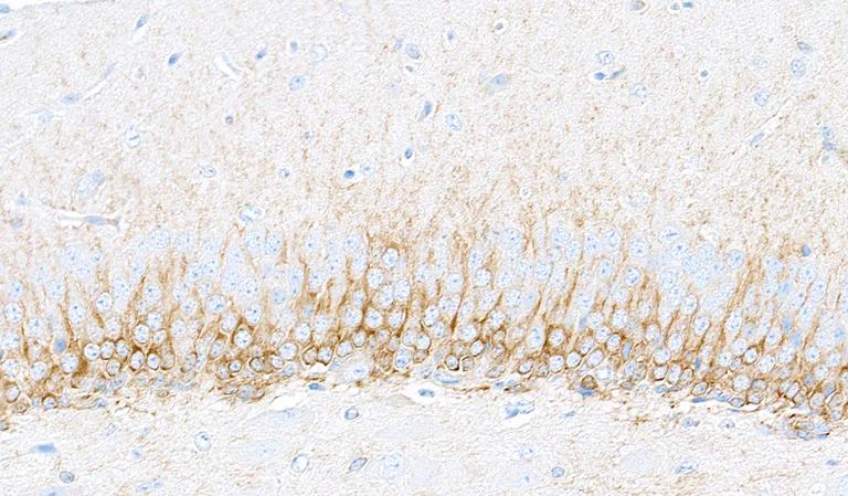 Immunohistochemistry (Formalin/PFA-fixed paraffin-embedded sections) - Anti-Doublecortin antibody [BLR168J] - BSA free (AB314076)