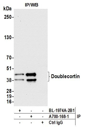 Immunoprecipitation - Anti-Doublecortin antibody [BLR168J] - BSA free (AB314076), expandable thumbnail
