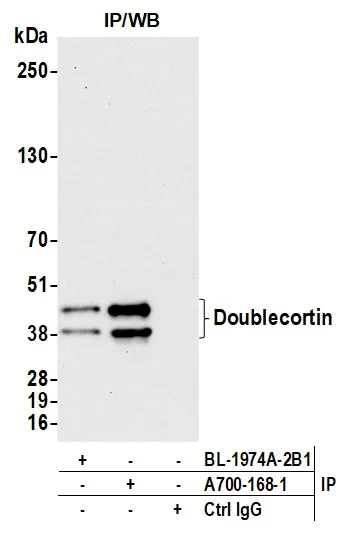 Immunoprecipitation - Anti-Doublecortin antibody [BLR168J] - BSA free (AB314076)