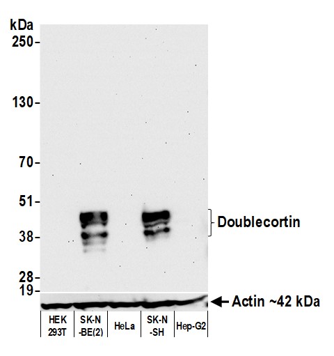 Western blot - Anti-Doublecortin antibody [BLR168J] - BSA free (AB314076), expandable thumbnail