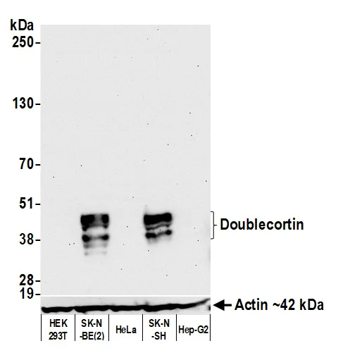 Western blot - Anti-Doublecortin antibody [BLR168J] - BSA free (AB314076)