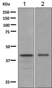 Western blot - Anti-Doublecortin antibody [EPR10935(B)] - BSA and Azide free (AB249418), expandable thumbnail