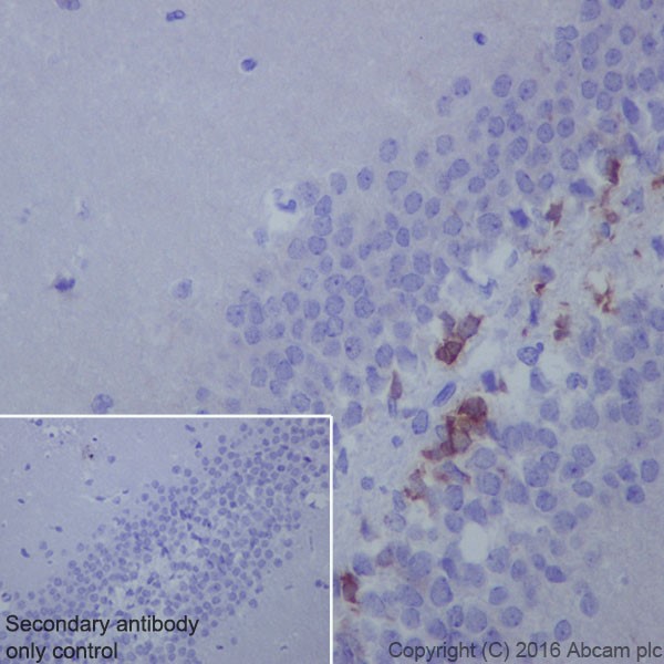 Immunohistochemistry (Formalin/PFA-fixed paraffin-embedded sections) - Anti-Doublecortin antibody [EPR19997] (AB207175), expandable thumbnail