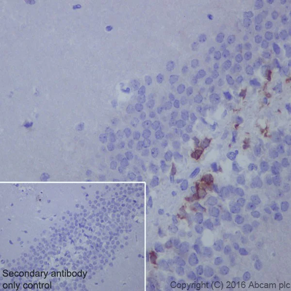 Immunohistochemistry (Formalin/PFA-fixed paraffin-embedded sections) - Anti-Doublecortin antibody [EPR19997] (AB207175)