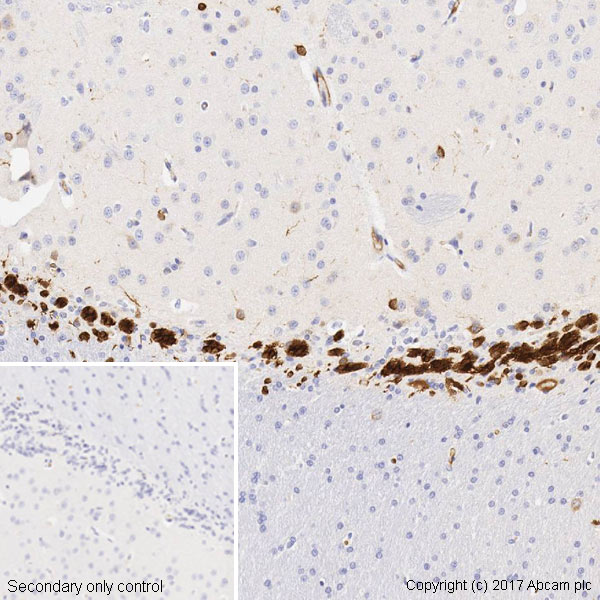 Immunohistochemistry (Formalin/PFA-fixed paraffin-embedded sections) - Anti-Doublecortin antibody [EPR19997] (AB207175), expandable thumbnail