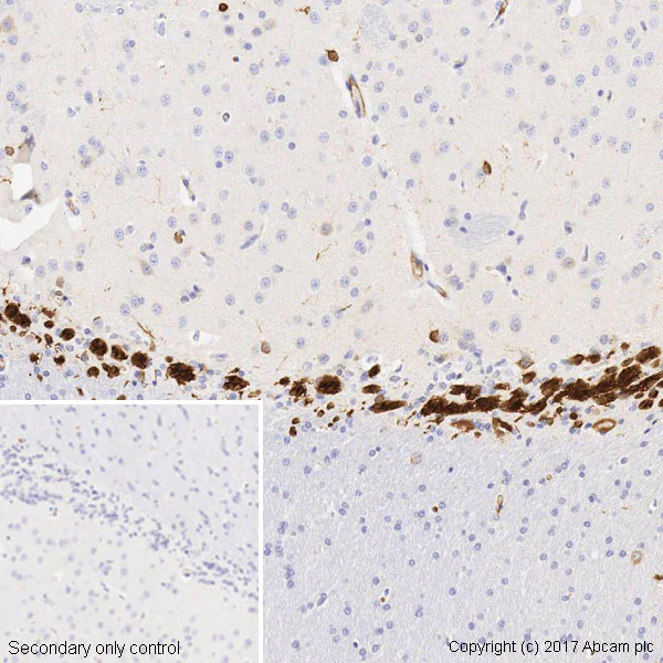 Immunohistochemistry (Formalin/PFA-fixed paraffin-embedded sections) - Anti-Doublecortin antibody [EPR19997] (AB207175)