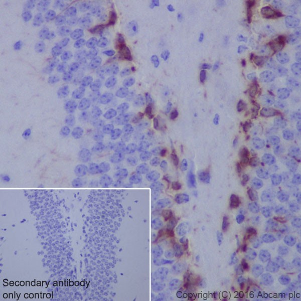 Immunohistochemistry (Formalin/PFA-fixed paraffin-embedded sections) - Anti-Doublecortin antibody [EPR19997] (AB207175), expandable thumbnail