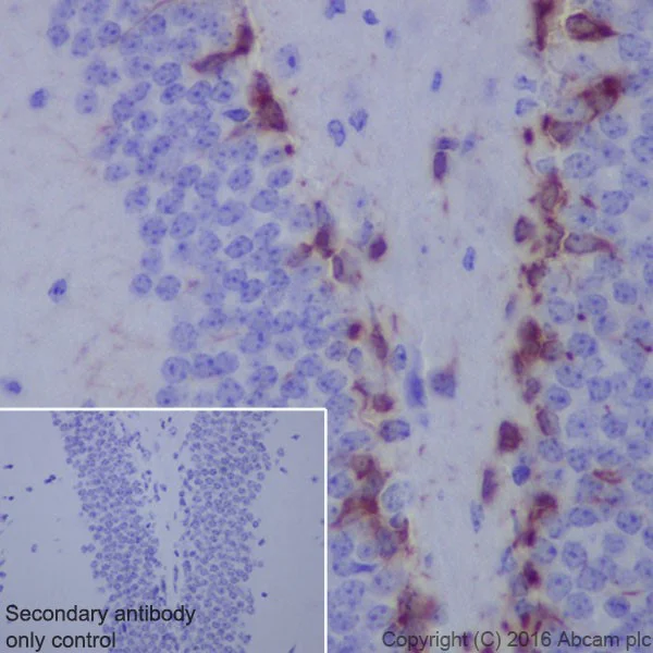 Immunohistochemistry (Formalin/PFA-fixed paraffin-embedded sections) - Anti-Doublecortin antibody [EPR19997] (AB207175)