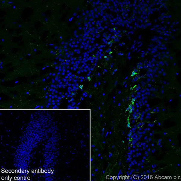 Immunohistochemistry (Frozen sections) - Anti-Doublecortin antibody [EPR19997] (AB207175)