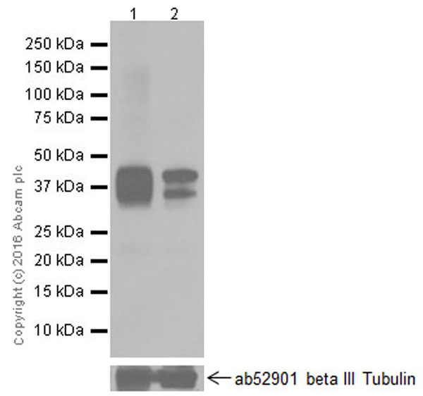 Western blot - Anti-Doublecortin antibody [EPR19997] (ab207175), expandable thumbnail