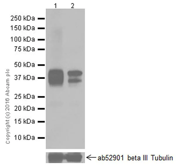 Western blot - Anti-Doublecortin antibody [EPR19997] (AB207175)