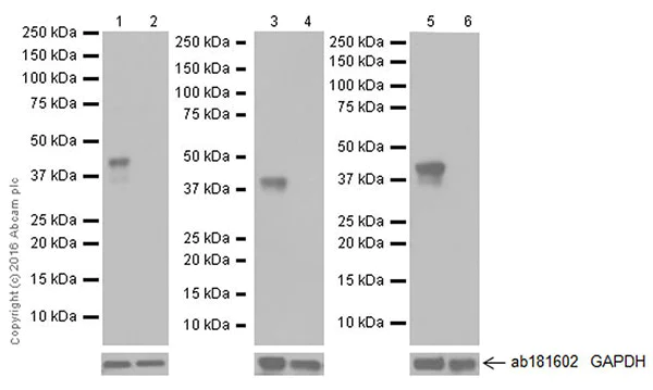 Western blot - Anti-Doublecortin antibody [EPR19997] (AB207175)