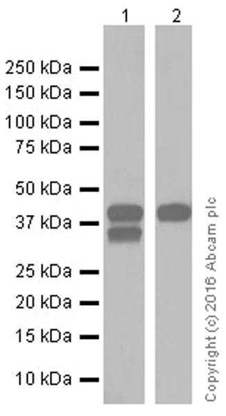 Western blot - Anti-Doublecortin antibody [EPR19997] (AB207175)