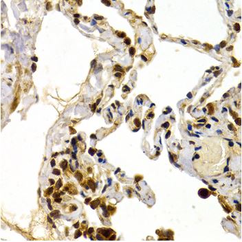 Immunohistochemistry (Formalin/PFA-fixed paraffin-embedded sections) - Anti-DP1 antibody (AB186831)