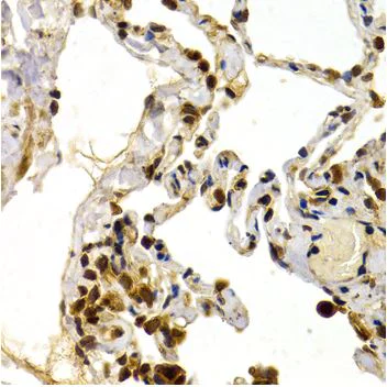 Immunohistochemistry (Formalin/PFA-fixed paraffin-embedded sections) - Anti-DP1 antibody (AB186831)