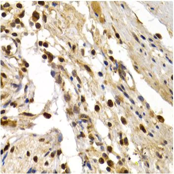 Immunohistochemistry (Formalin/PFA-fixed paraffin-embedded sections) - Anti-DP1 antibody (AB186831)