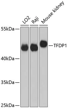 Western blot - Anti-DP1 antibody (AB186831)