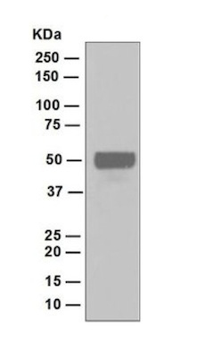 Western blot - Anti-DP1 antibody [EPR4959(2)] (AB124678), expandable thumbnail