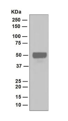 Western blot - Anti-DP1 antibody [EPR4959(2)] (AB124678)