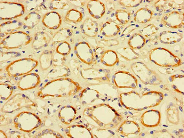 Immunohistochemistry (Formalin/PFA-fixed paraffin-embedded sections) - Anti-DP2 antibody (AB235830)