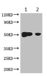 Western blot - Anti-DP2 antibody (AB235830)