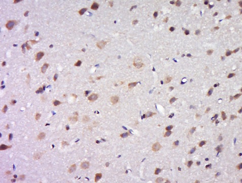 Immunohistochemistry (Formalin/PFA-fixed paraffin-embedded sections) - Anti-DPAGT1/GPT antibody (AB214179)