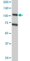 Western blot - Anti-DPD antibody [7D4] (AB54797), expandable thumbnail