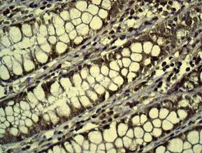 Immunohistochemistry (Formalin/PFA-fixed paraffin-embedded sections) - Anti-DPD antibody [EPR8811] (AB134922)