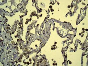 Immunohistochemistry (Formalin/PFA-fixed paraffin-embedded sections) - Anti-DPD antibody [EPR8811] (AB134922)