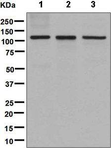 Western blot - Anti-DPD antibody [EPR8811] (AB134922)