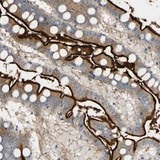 Immunohistochemistry (Formalin/PFA-fixed paraffin-embedded sections) - Anti-DPEP1/MDP antibody (AB121308)
