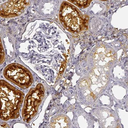 Immunohistochemistry (Formalin/PFA-fixed paraffin-embedded sections) - Anti-DPEP1/MDP antibody (AB121308)